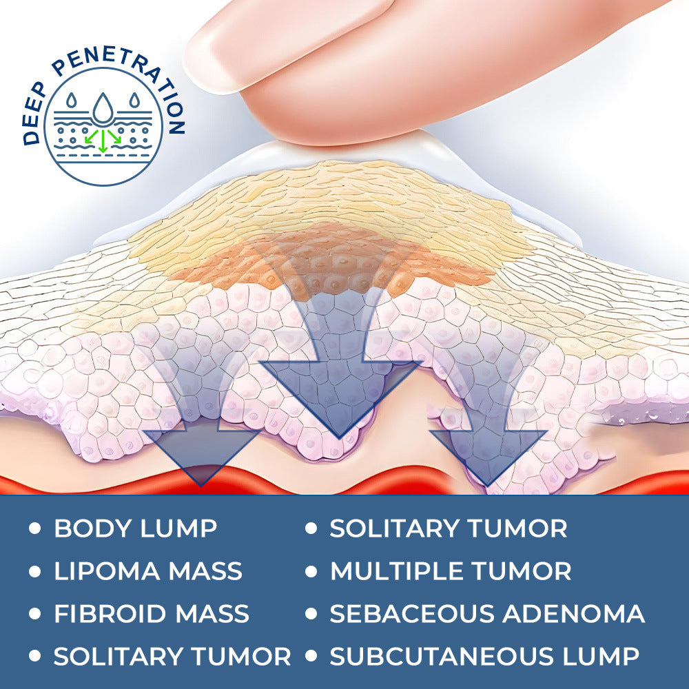 Lipoma Cream – Creme para Lipomas